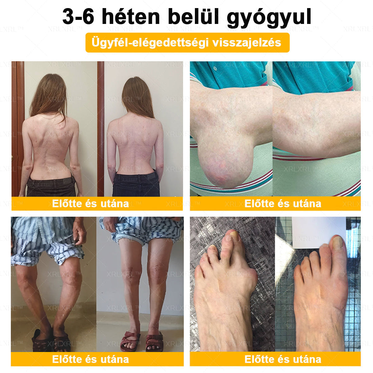 🔅💜𝑿𝑹𝑳𝑿𝑹𝑳® Botulinum Toxin és Méhméreg Fájdalomcsillapító Csontgyógyító Krém (Speziell für ältere Erwachsene)