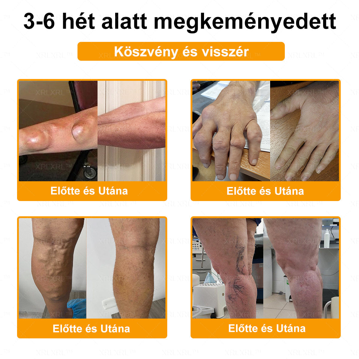 🔅💜𝑿𝑹𝑳𝑿𝑹𝑳® Botulinum Toxin és Méhméreg Fájdalomcsillapító Csontgyógyító Krém (Speziell für ältere Erwachsene)