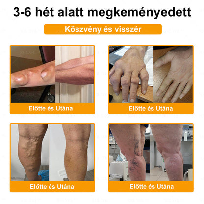 🔅💜𝑿𝑹𝑳𝑿𝑹𝑳® Botulinum Toxin és Méhméreg Fájdalomcsillapító Csontgyógyító Krém (Speziell für ältere Erwachsene)