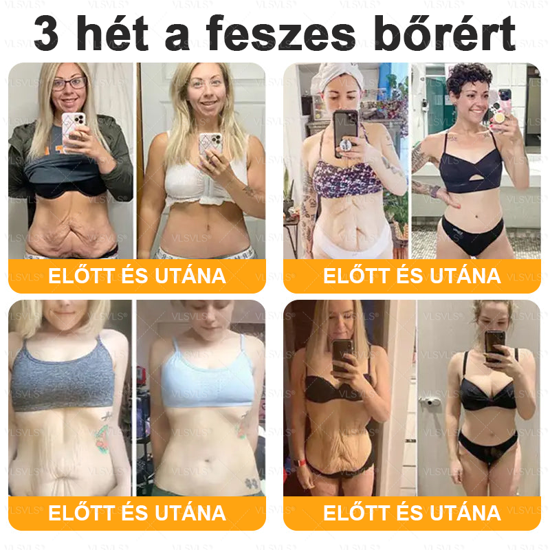 🎉🌟VLSVLS® Méhméreg Átfogó Krém (Minden korosztály számára alkalmas )