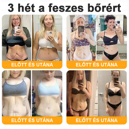 🎉🌟VLSVLS® Méhméreg Átfogó Krém (Minden korosztály számára alkalmas )