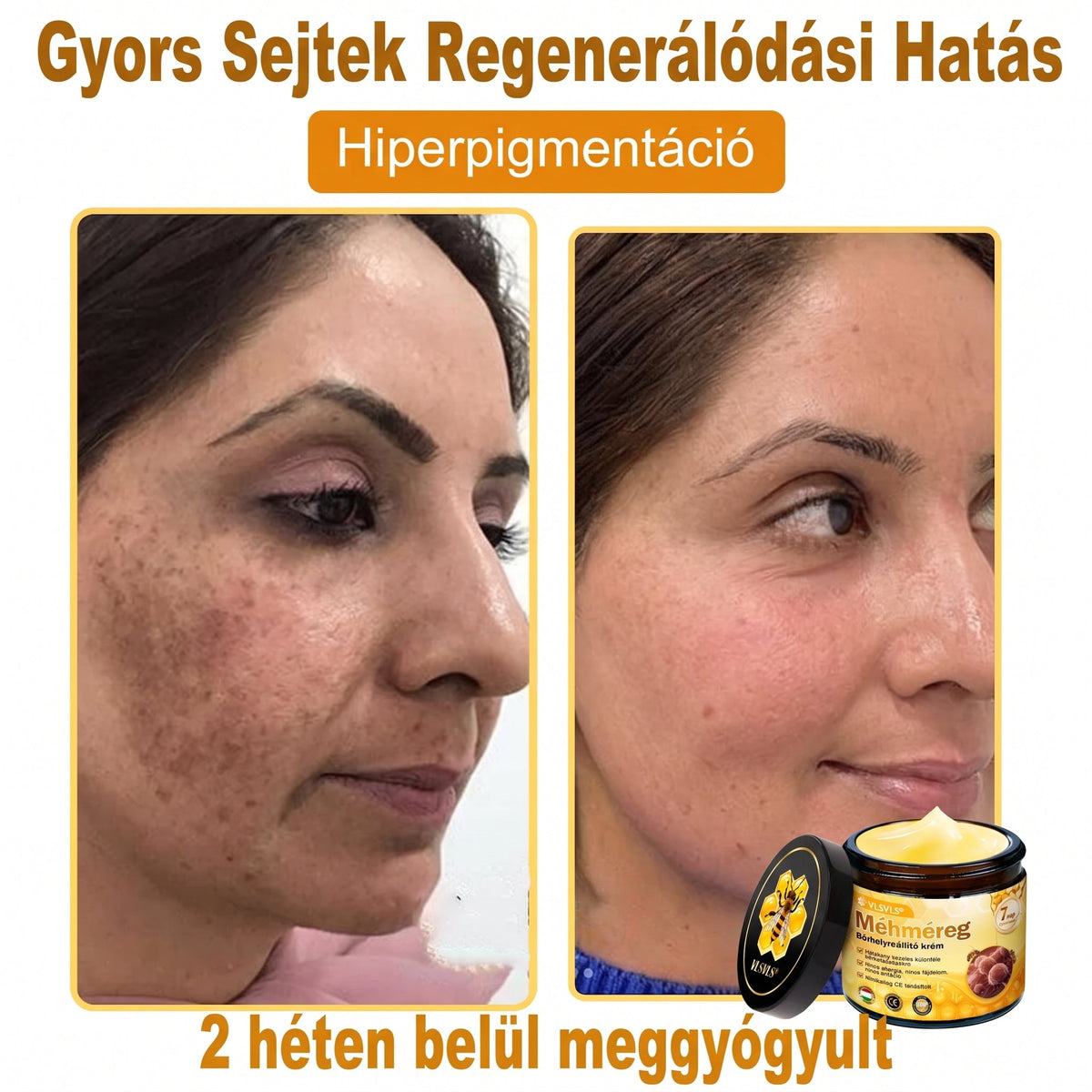 💥💥𝑽𝙇𝙎𝑽𝑳𝑺® Méhméreg Bőr Helyreállító Krém (👨‍⚕‍CE Tanúsítvány)👍✅