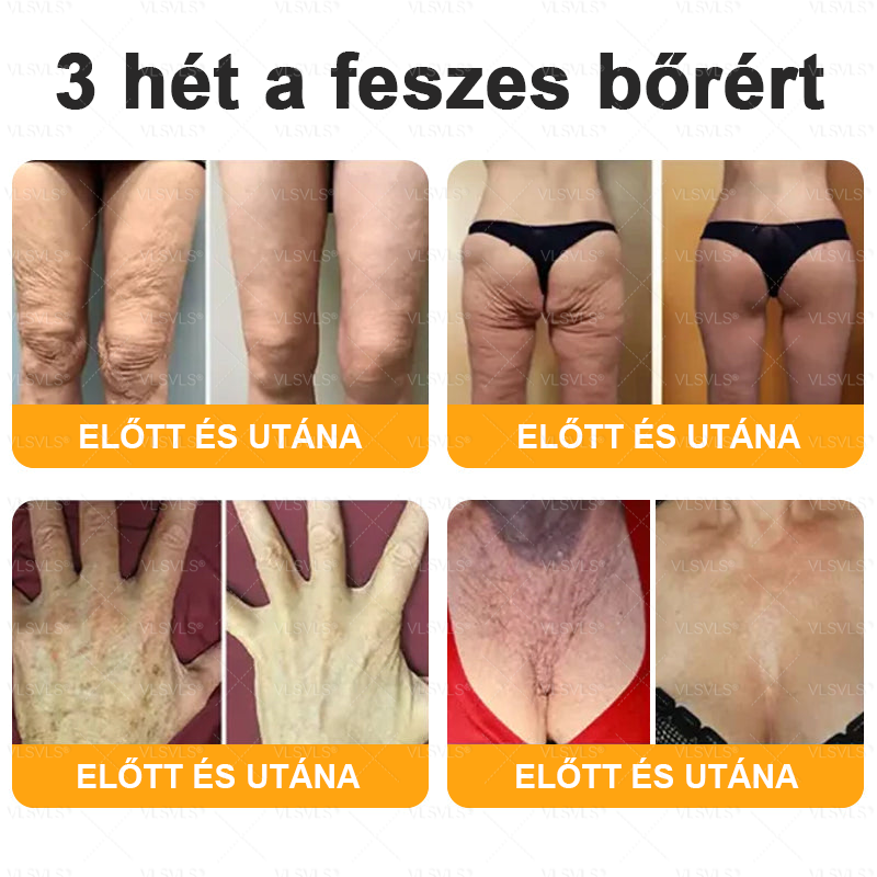 🎉🌟VLSVLS® Méhméreg Átfogó Krém (Minden korosztály számára alkalmas )