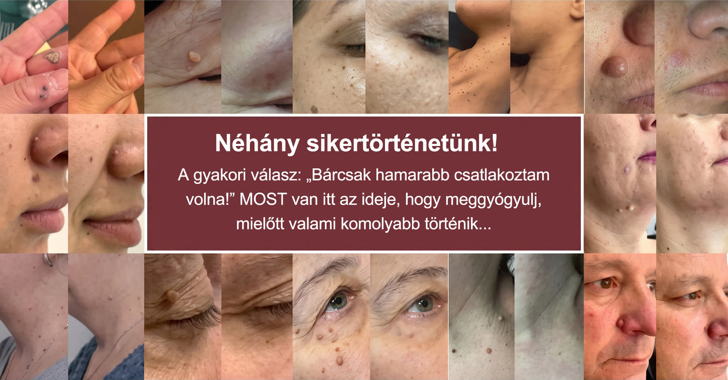 🎁🎁🎁 𝐇𝐈𝐒𝐊𝐈𝐍® Utolsó lehetőség! Ragadja meg ezt a különleges ajánlatot 70% kedvezménnyel!