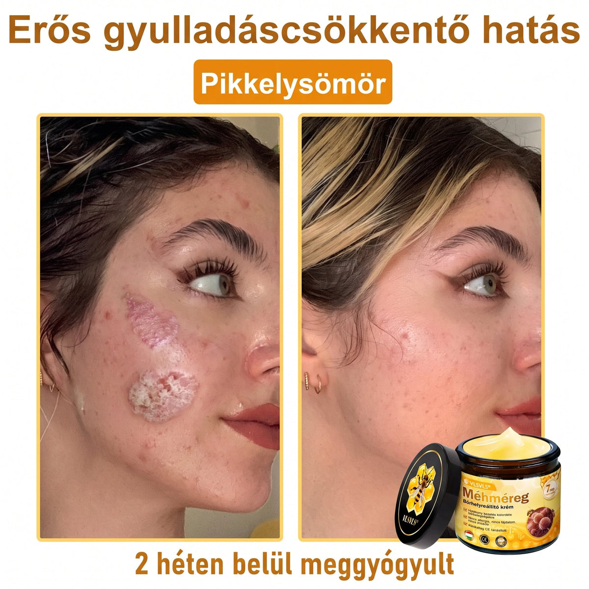 💥💥𝑽𝙇𝙎𝑽𝑳𝑺® Méhméreg Bőr Helyreállító Krém (👨‍⚕‍CE Tanúsítvány)👍✅