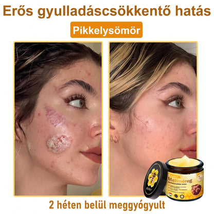💥💥𝑽𝙇𝙎𝑽𝑳𝑺® Méhméreg Bőr Helyreállító Krém (👨‍⚕‍CE Tanúsítvány)👍✅