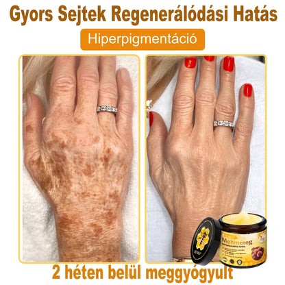 💥💥𝑽𝙇𝙎𝑽𝑳𝑺® Méhméreg Bőr Helyreállító Krém (👨‍⚕‍CE Tanúsítvány)👍✅