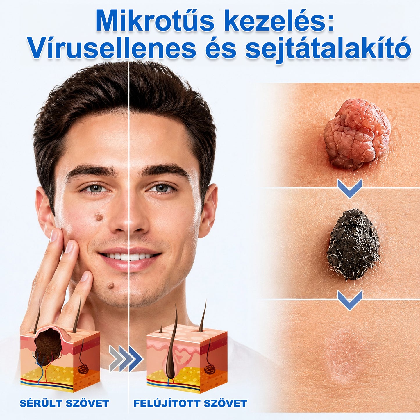 🎁🎁🎁 𝐇𝐈𝐒𝐊𝐈𝐍® Utolsó lehetőség! Ragadja meg ezt a különleges ajánlatot 70% kedvezménnyel!
