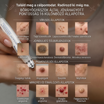 💙𝐇𝐈𝐒𝐊𝐈𝐍®👩‍⚕️ Címke és Folt Eltávolító 7 Nap – Fájdalommentes, Hegmentes Fejlett Bőrhibák Eltávolító Golyós Toll