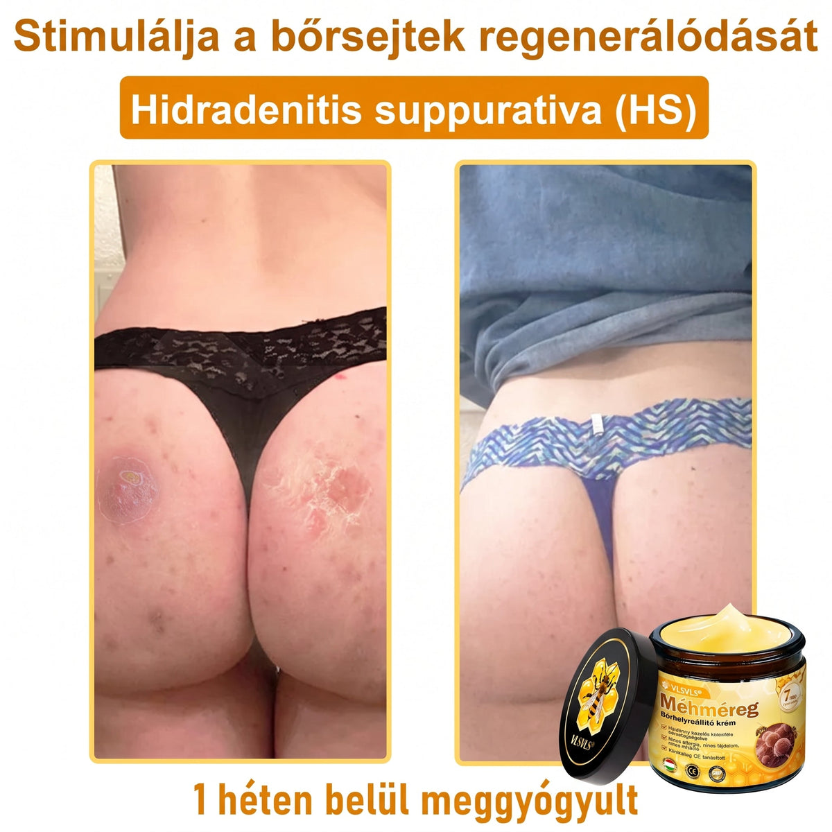💥💥𝑽𝙇𝙎𝑽𝑳𝑺® Méhméreg Bőr Helyreállító Krém (👨‍⚕‍CE Tanúsítvány)👍✅
