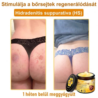 💥💥𝑽𝙇𝙎𝑽𝑳𝑺® Méhméreg Bőr Helyreállító Krém (👨‍⚕‍CE Tanúsítvány)👍✅