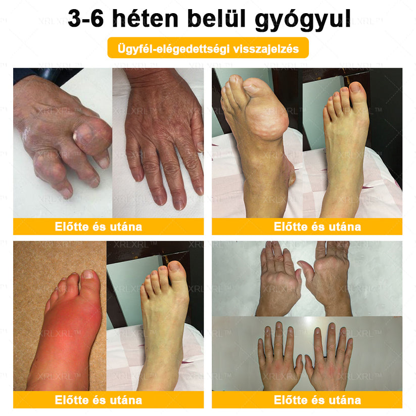 🔅💜𝑿𝑹𝑳𝑿𝑹𝑳® Botulinum Toxin és Méhméreg Fájdalomcsillapító Csontgyógyító Krém (Speziell für ältere Erwachsene)