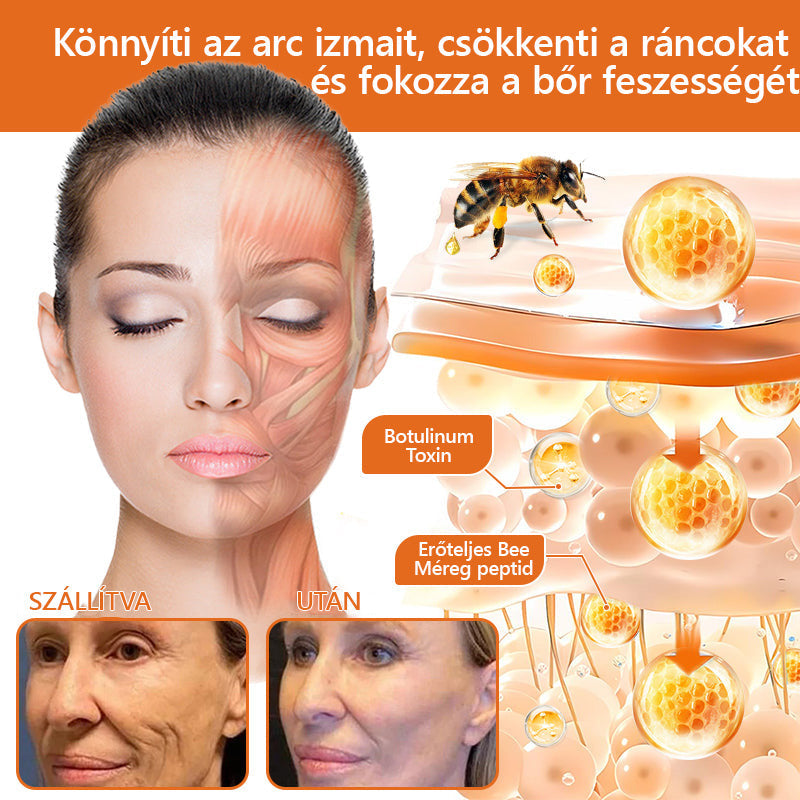 💥💥𝑽𝙇𝙎𝑽𝑳𝑺® Méhméreg Bőr Helyreállító Krém (👨‍⚕‍CE Tanúsítvány)👍✅