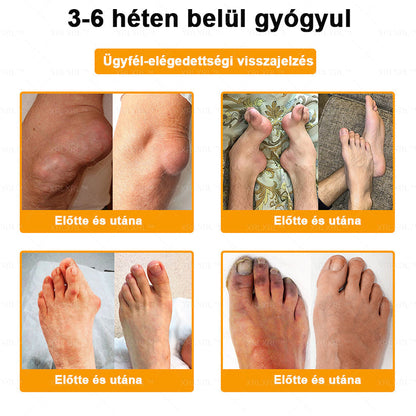 🔅💜𝑿𝑹𝑳𝑿𝑹𝑳® Botulinum Toxin és Méhméreg Fájdalomcsillapító Csontgyógyító Krém (Speziell für ältere Erwachsene)
