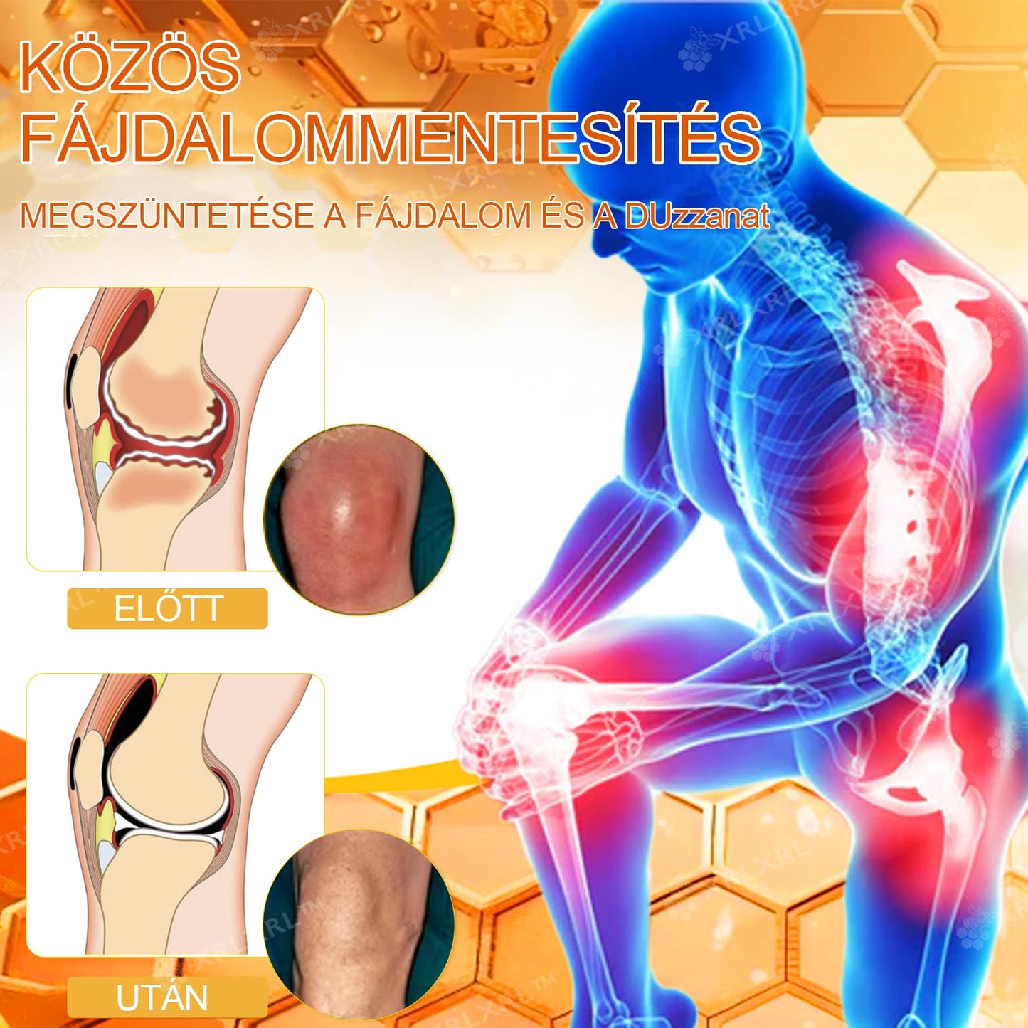 XRLXRL® 🎁🎁🎁 Csak 10 csomag maradt! További 50% kedvezményt biztosítunk Önnek! Ne maradjon le róla most, mert erre az ajánlatra legközelebb csak jövőre lesz lehetősége.
