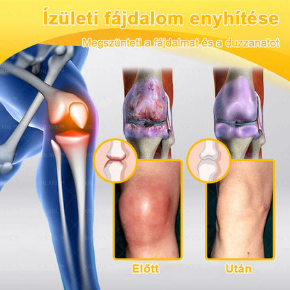 🔅💜𝑿𝑹𝑳𝑿𝑹𝑳® Botulinum Toxin és Méhméreg Fájdalomcsillapító Csontgyógyító Krém (Speziell für ältere Erwachsene)