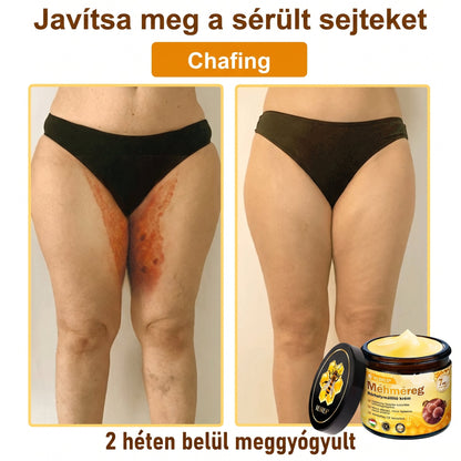 💥💥𝑽𝙇𝙎𝑽𝑳𝑺® Méhméreg Bőr Helyreállító Krém (👨‍⚕‍CE Tanúsítvány)👍✅