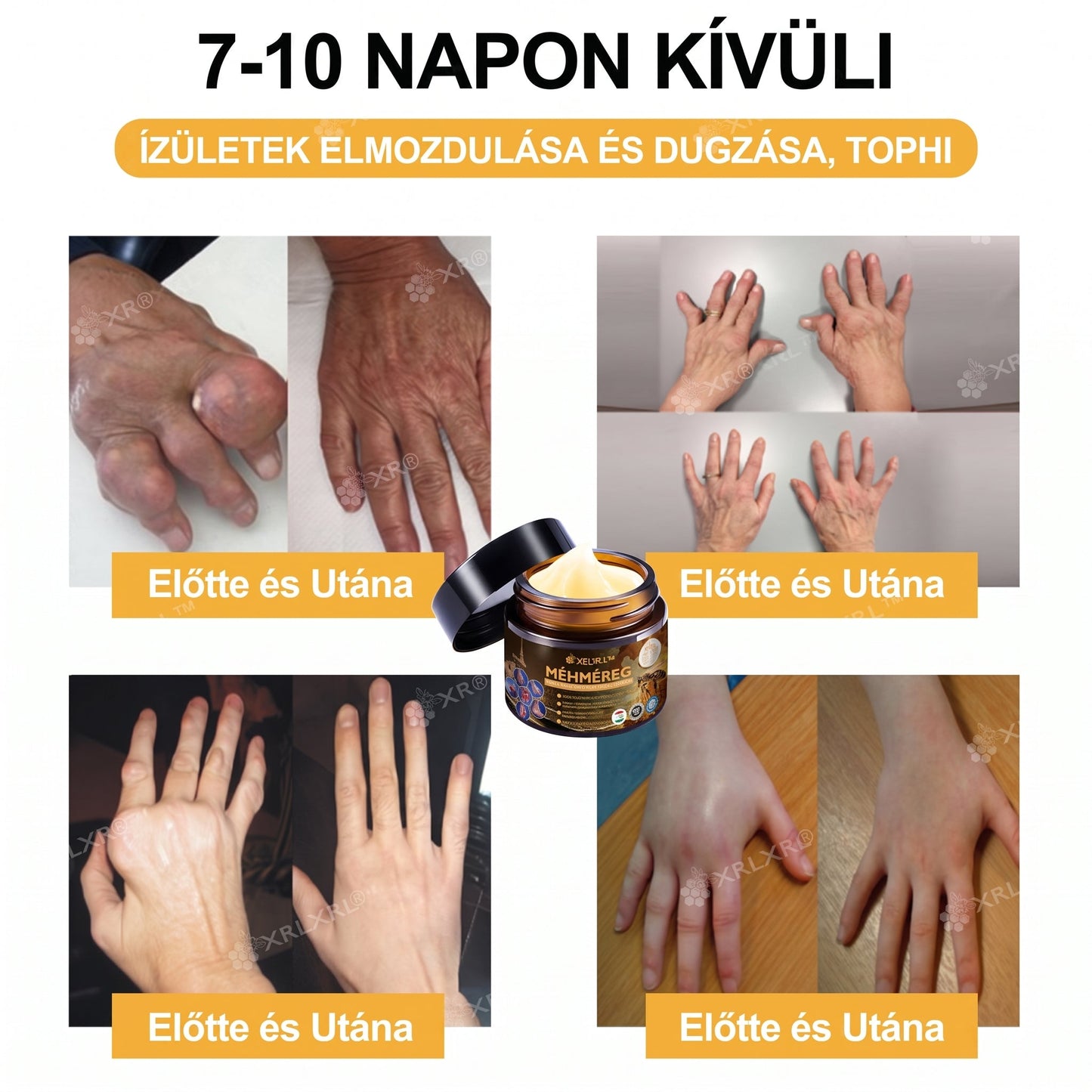 XRLXRL® 🎁🎁🎁 Csak 10 csomag maradt! További 50% kedvezményt biztosítunk Önnek! Ne maradjon le róla most, mert erre az ajánlatra legközelebb csak jövőre lesz lehetősége.