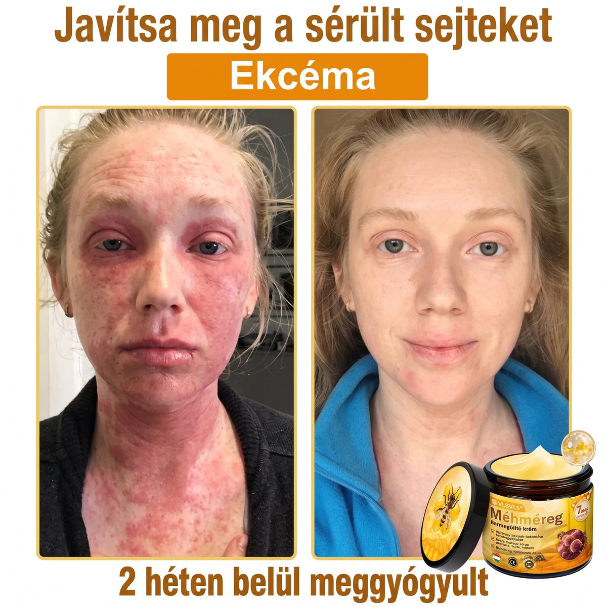 💥💥𝑽𝙇𝙎𝑽𝑳𝑺® Méhméreg Bőr Helyreállító Krém (👨‍⚕‍CE Tanúsítvány)👍✅