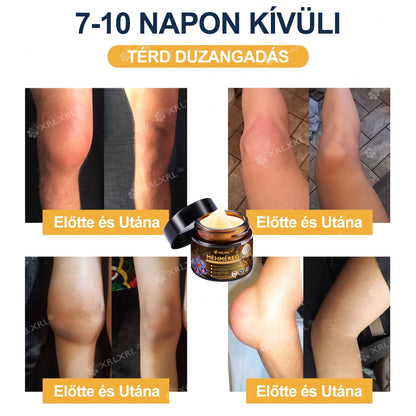 XRLXRL® 🎁🎁🎁 Csak 10 csomag maradt! További 50% kedvezményt biztosítunk Önnek! Ne maradjon le róla most, mert erre az ajánlatra legközelebb csak jövőre lesz lehetősége.