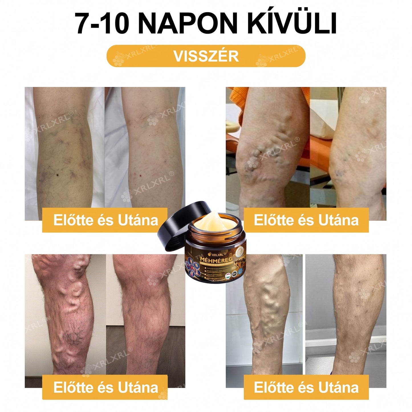 XRLXRL® 🎁🎁🎁 Csak 10 csomag maradt! További 50% kedvezményt biztosítunk Önnek! Ne maradjon le róla most, mert erre az ajánlatra legközelebb csak jövőre lesz lehetősége.