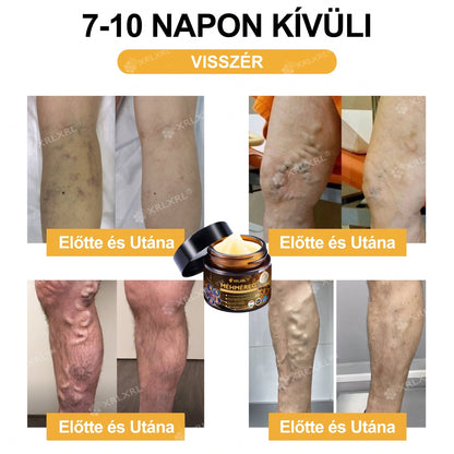 XRLXRL® 🎁🎁🎁 Csak 10 csomag maradt! További 50% kedvezményt biztosítunk Önnek! Ne maradjon le róla most, mert erre az ajánlatra legközelebb csak jövőre lesz lehetősége.